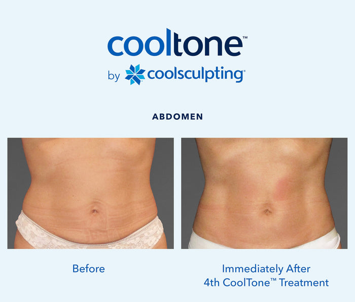CoolTone
