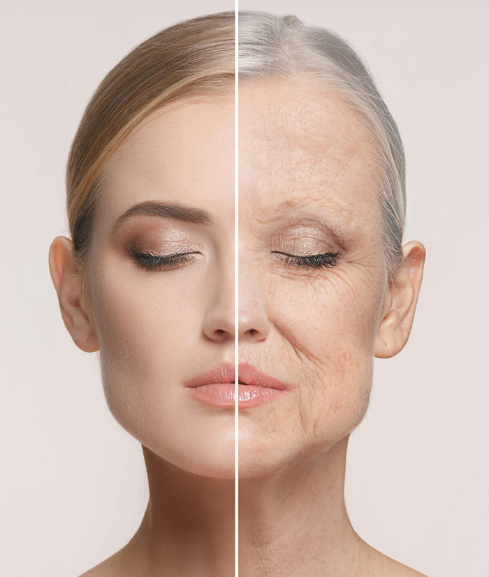 Restylane